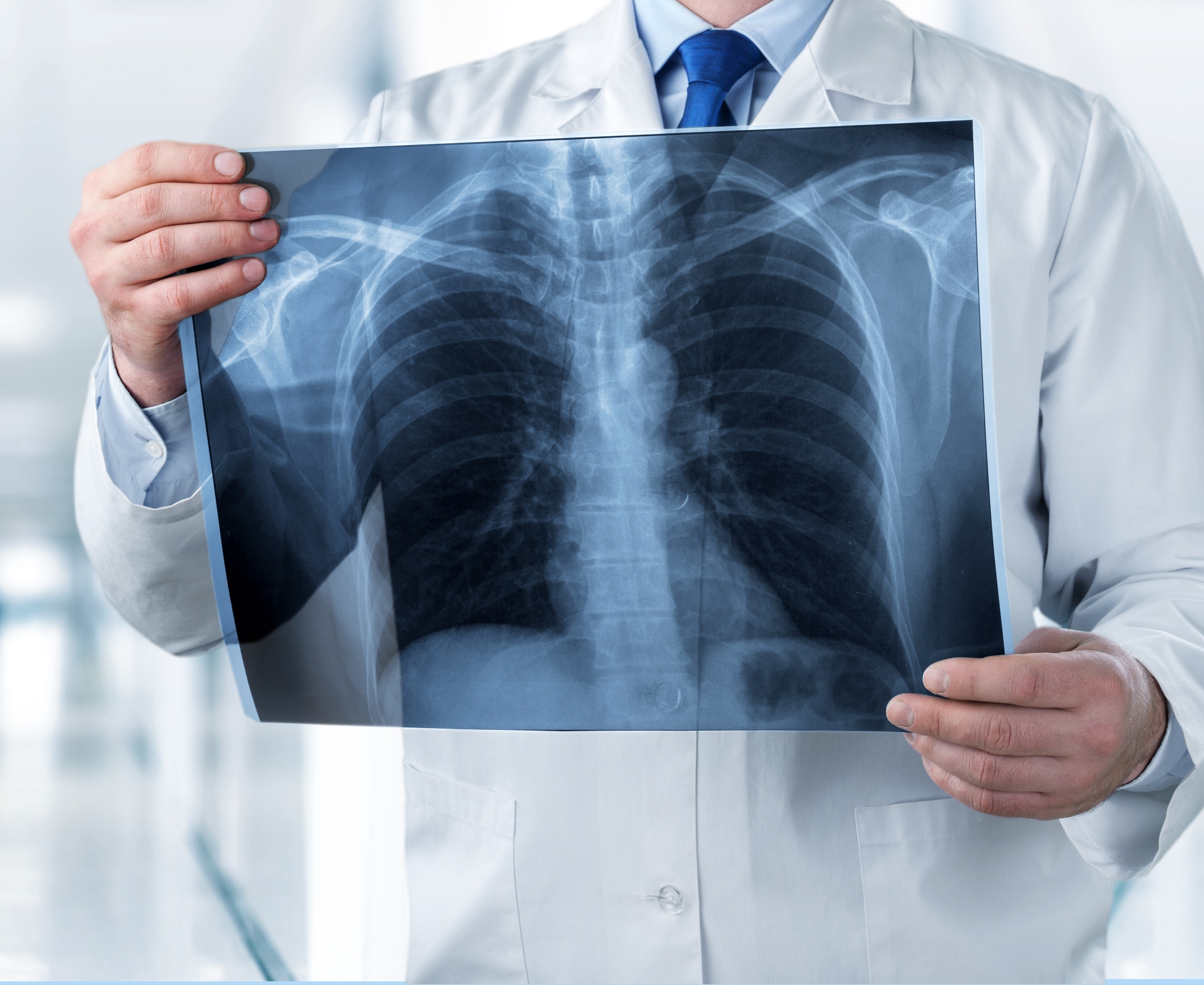 x-ray-ser_1688042294AG7hpB.png