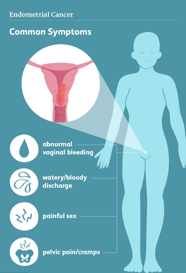 uterine-ca_1688115379zouJ90.png