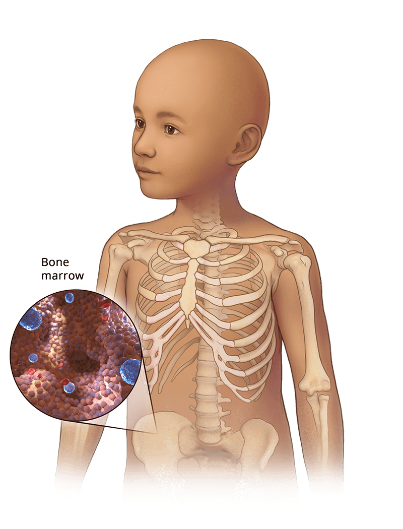 bone-marro_1688117200Y2qfCi.png