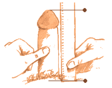 abnormal-p_16882039485ff09M.png