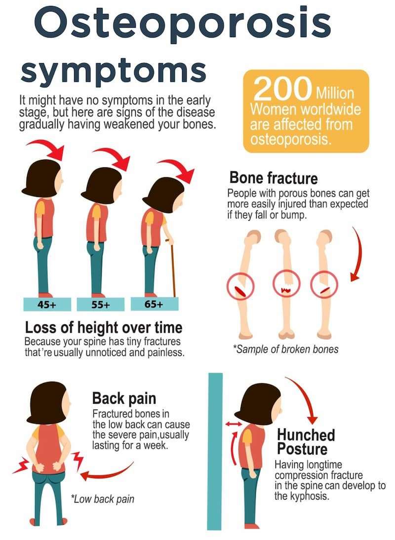 osteoporos_1688207934O4uKPW.jpeg