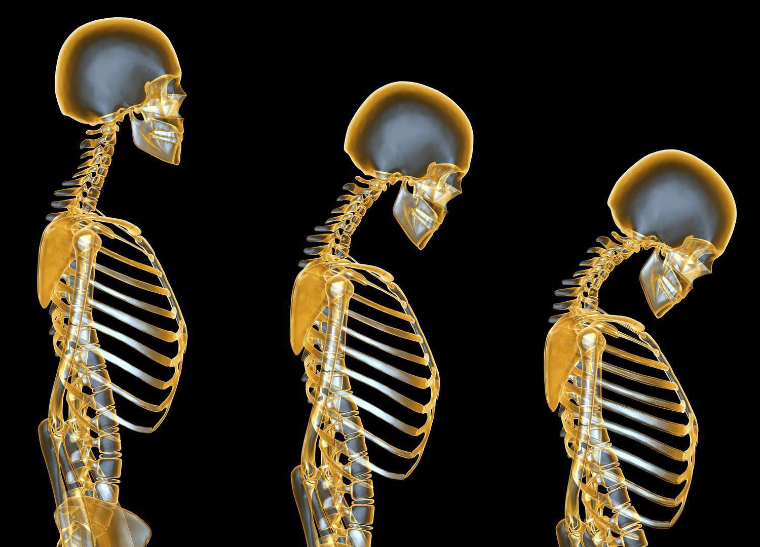 osteoporos_1688207934bjbFPK.jpeg
