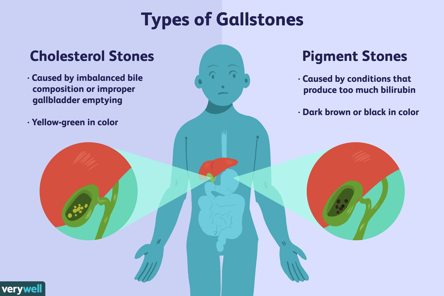 gallbladde_1688278891BOCmsd.png