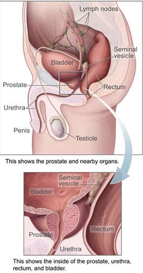 prostate-e_16882792363c9xiF.jpeg