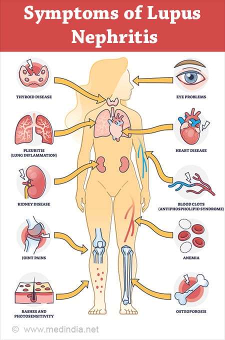 nephritis_1688279815isixY0.jpeg