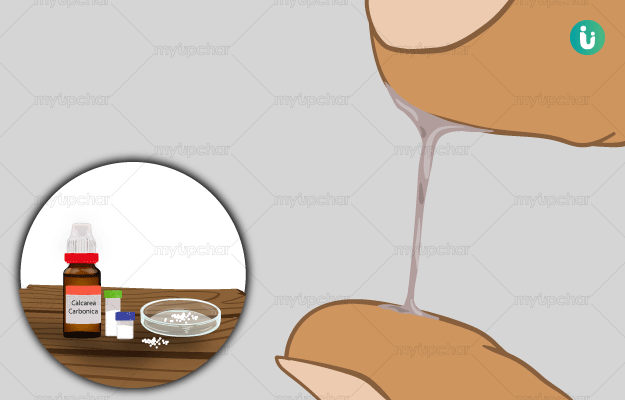 leucorrhea_1688280084GfgniY.png