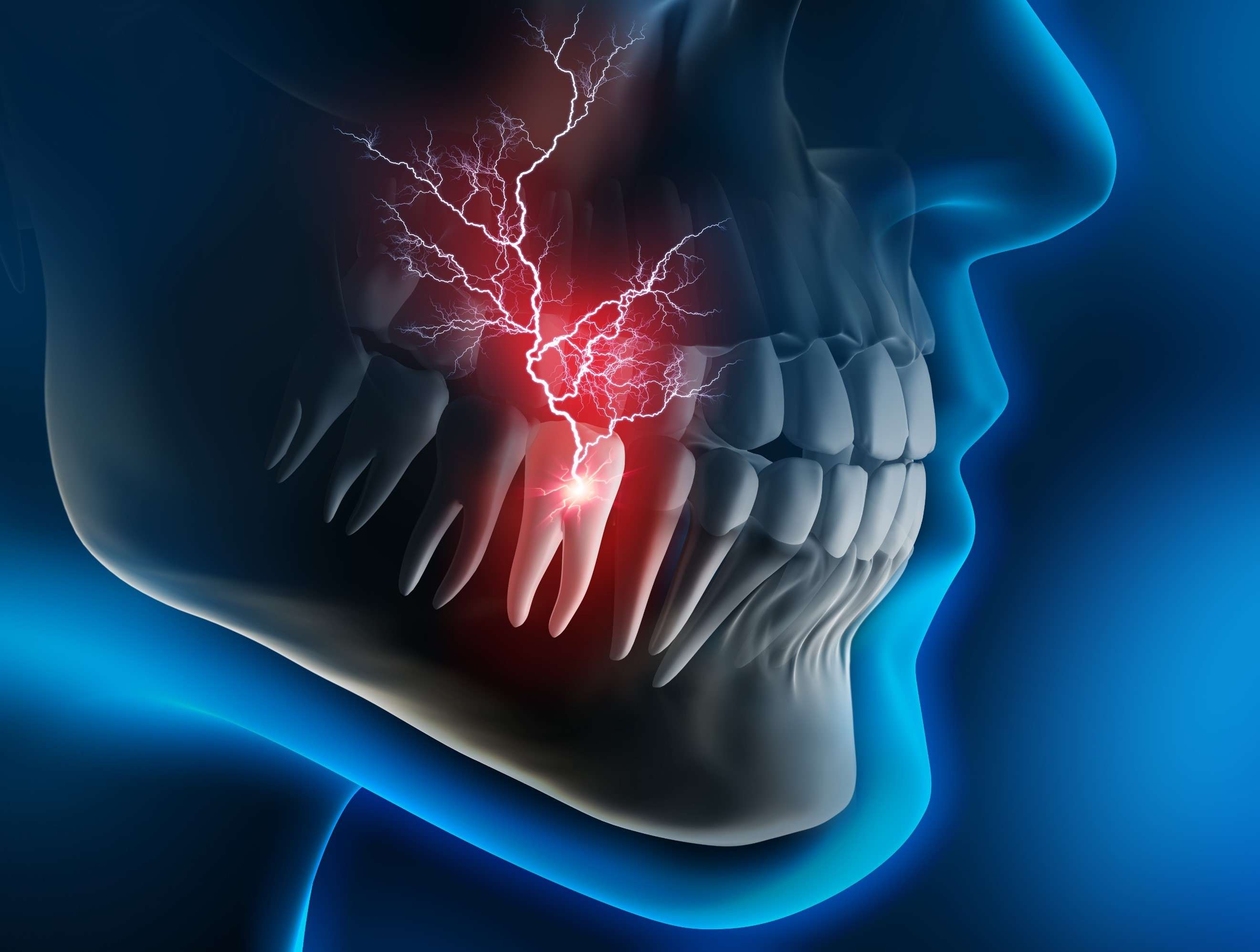 toothache_16882812613WnlZD.jpeg
